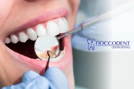 FIOCCODENT centri dentali