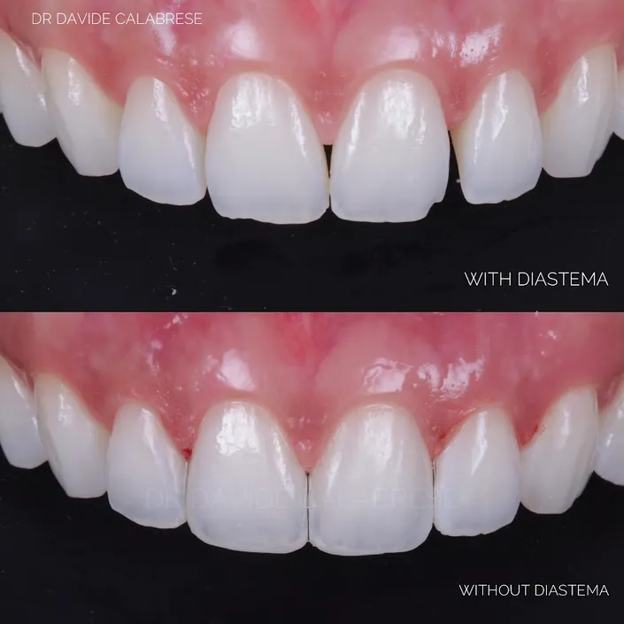 Dr Calabrese Davide smile & lips
