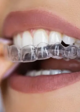 Giulia Massano Dentista
