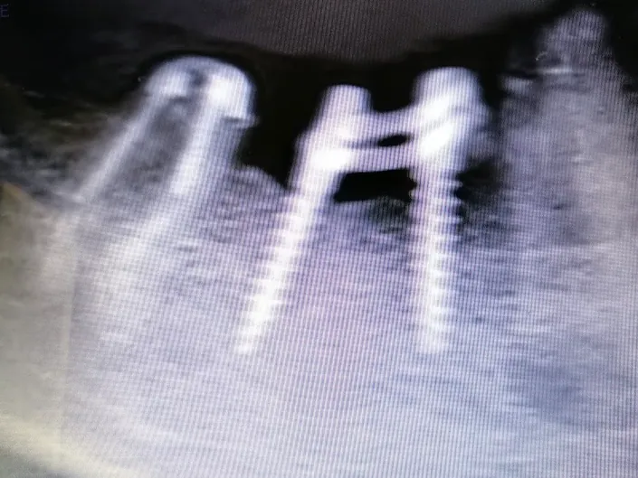 Studio Dentistico Implantologico Valli Dr. Fabio Medico Chirurgo Odontoiatra